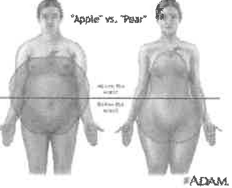 How to get rid 2024 of apple shaped body